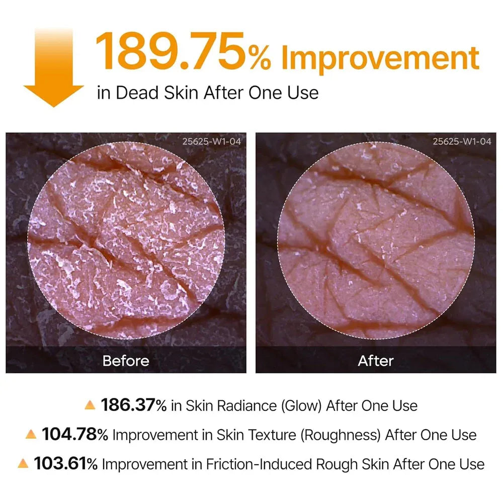 Dr.Melaxin - Peel Shot Kojic Acid Spray