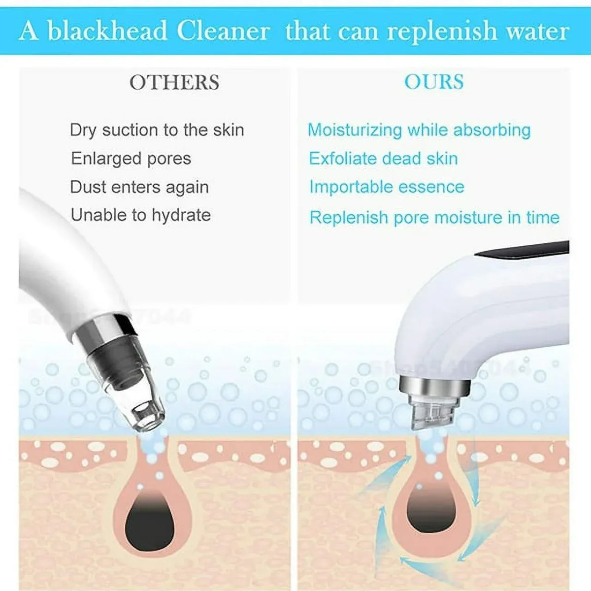 Electric Pore Vacuum Blackhead Remover Skin Care