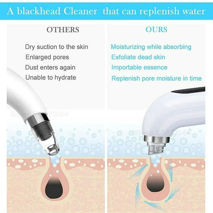 Electric Pore Vacuum Blackhead Remover Skin Care