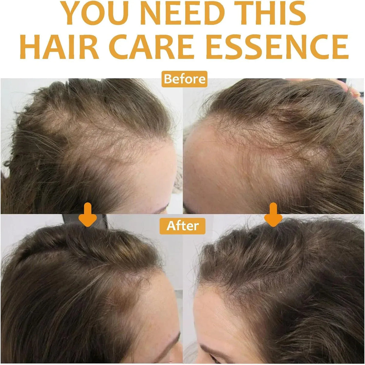 OUHOE Biotin Hair Growth Serum 30ml