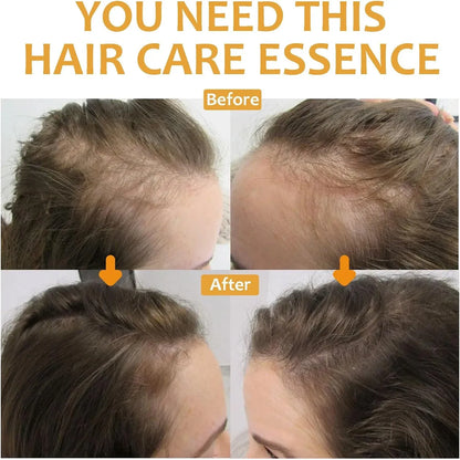 OUHOE Biotin Hair Growth Serum 30ml