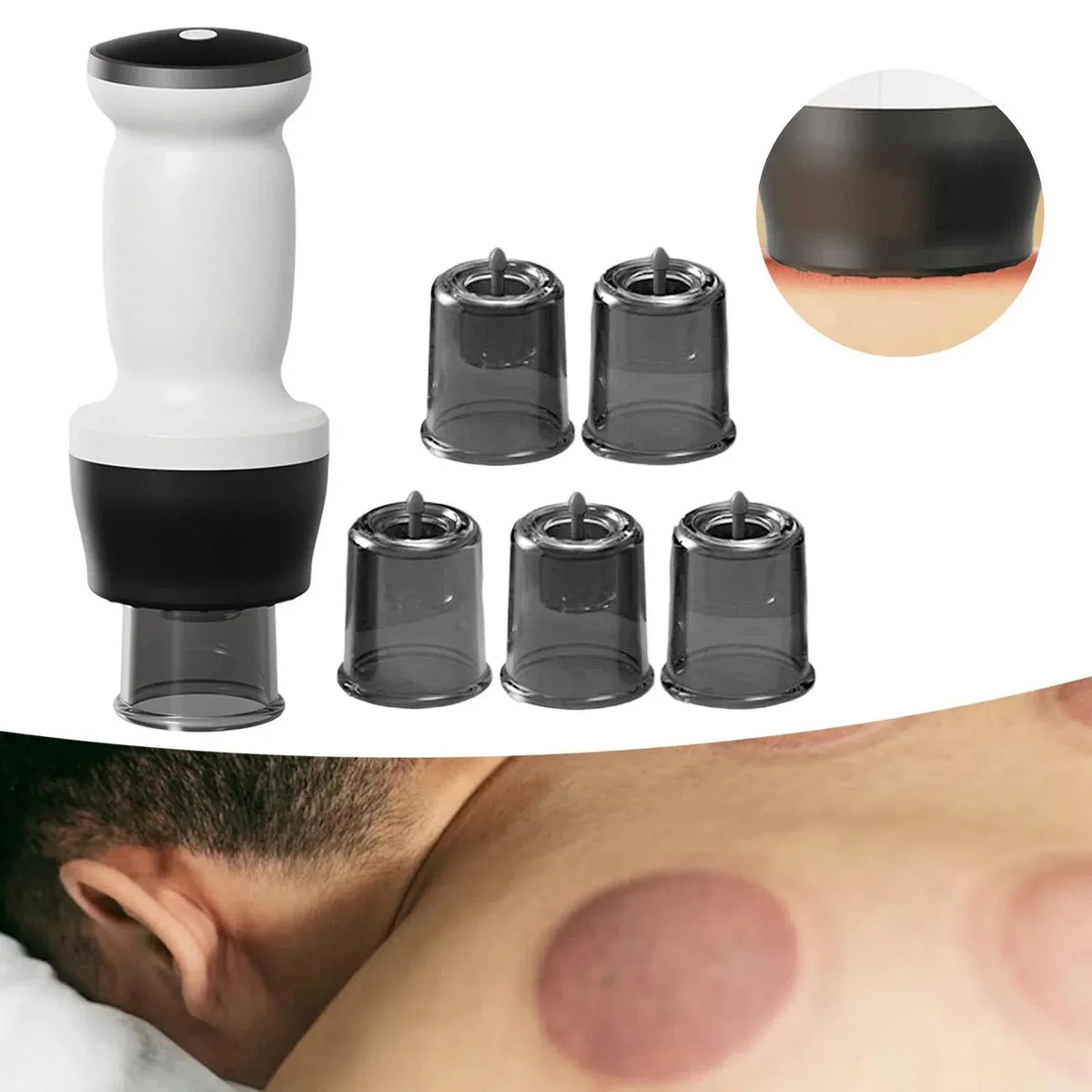 Smart Negative Pressure Cupping Massager