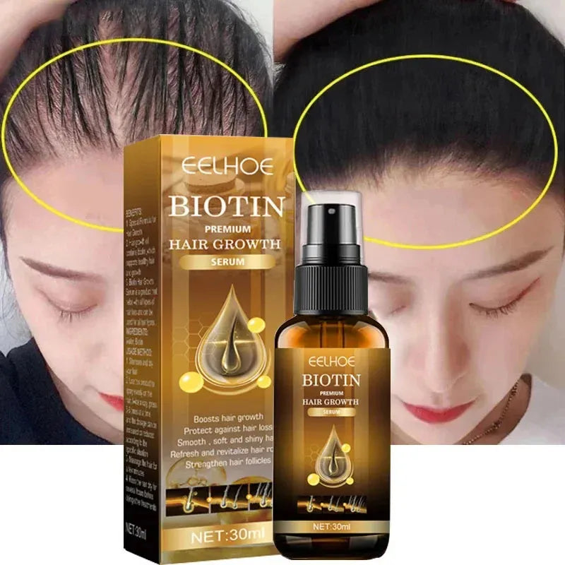 OUHOE Biotin Hair Growth Serum 30ml