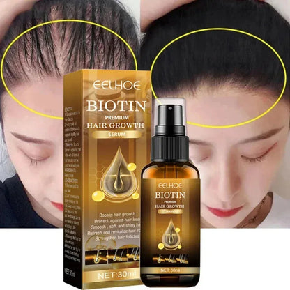 OUHOE Biotin Hair Growth Serum 30ml