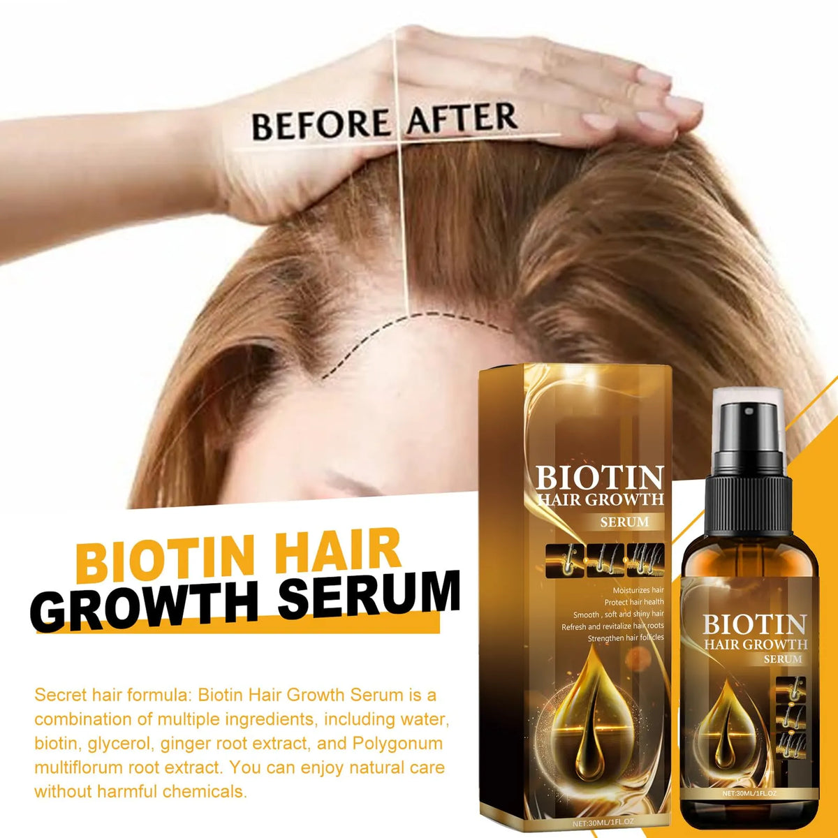 OUHOE Biotin Hair Growth Serum 30ml