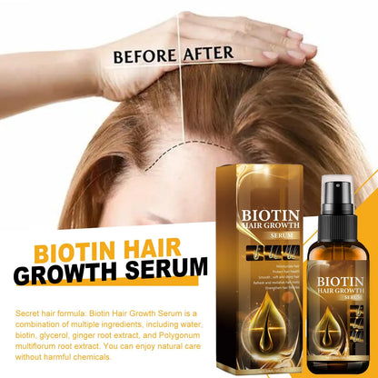 OUHOE Biotin Hair Growth Serum 30ml
